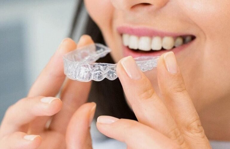 Dental Blush invisalign-770x500 Our Services  
