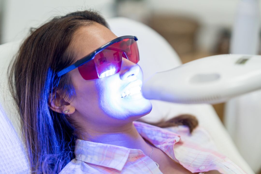 Dental Blush teeth_whitening Teeth Whitening in Miami  