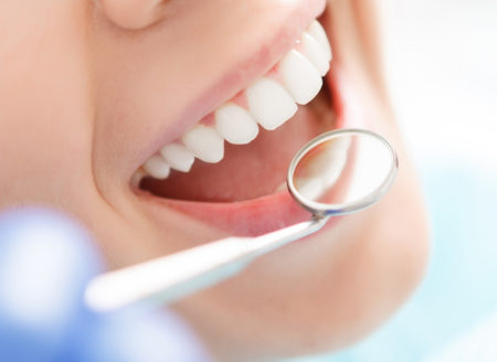 Dental Blush accept_insurance-450x328 Appointment Today  
