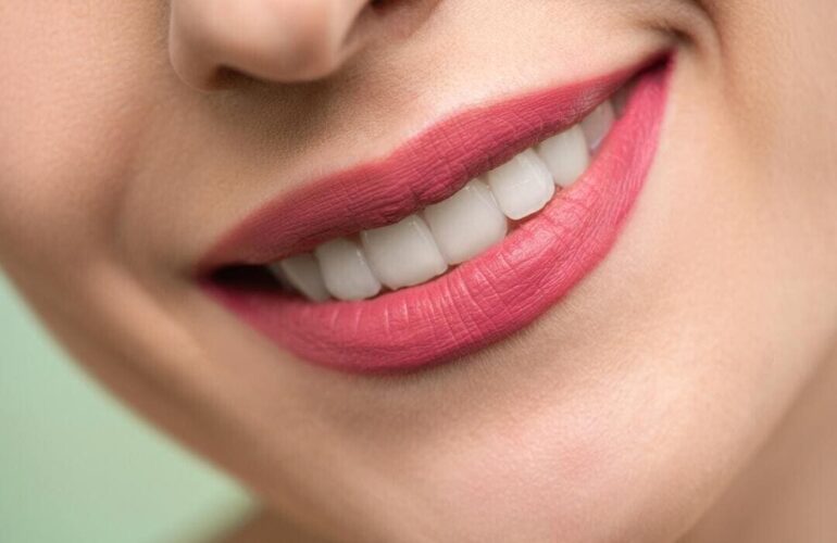 Dental Blush smile-design-770x500 Our Services  