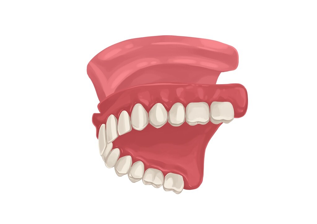 Dental Blush dentures Improving Lives: The Benefits of Dentures for Your Smile and Health Dental  Dentures near me Dentures Miami Dentures Benefits of Dentures 