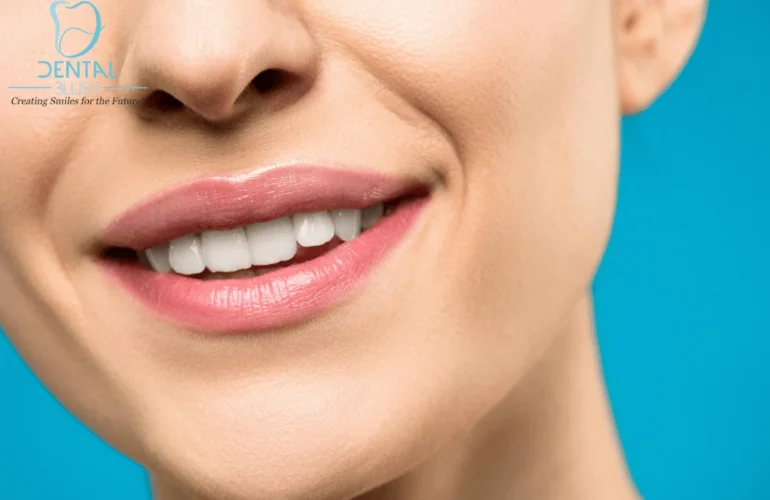 Dental Blush 1-2-770x500 Teeth whitening What are the different cultural perspectives? Dental  