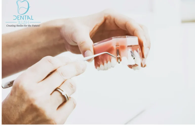 Dental Blush Tamiami FL How-Proper-Oral-Hygiene-Improve-Overall-Health-770x500 Home  